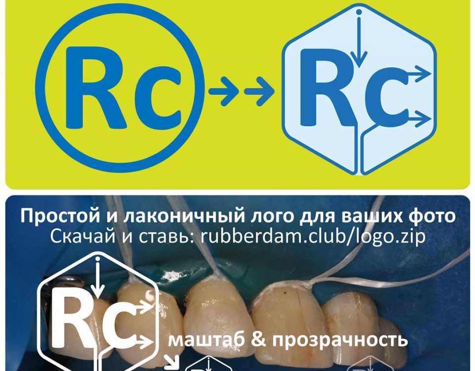 Новый лого у проекта #rubberdamclub Вы так же можете значительно улучшить оформление своих клинических фотографий скачав по ссылке http://rubberdam.club/logo.zip этот лого и наносить его в графическом редакторе в уголочек своих фотографий. Будем вам премного благодарны.